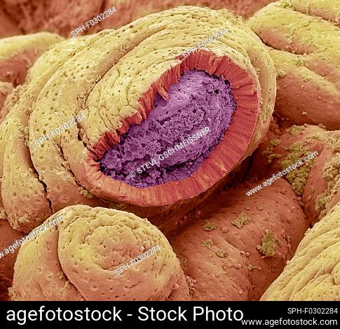 Intestinal lining. Coloured scanning electron micrograph (SEM) of a freeze-fractured of the small intestine. The surface consists of deep folds, called villi