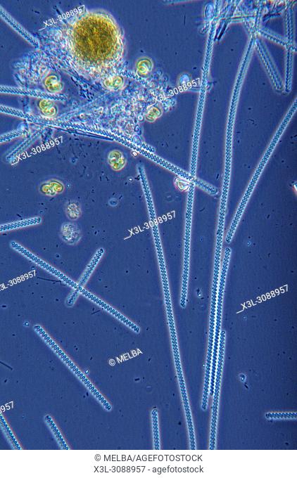 Spirulina sp. Cyanobacteria. Prokaryotes. Optic microscopy