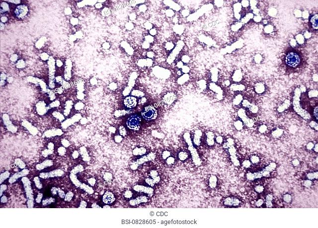 HEPATITIS B VIRUS<BR>This electron micrograph reveals the presence of hepatitis-B virus HBV 'Dane particles', or virions