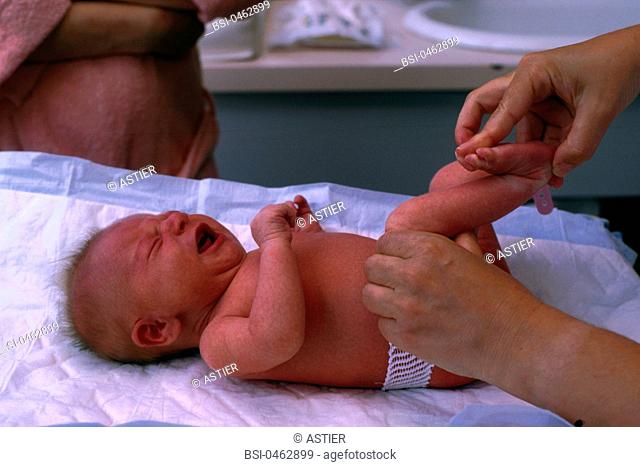 Pediatrician at the maternity exami-ning a 2 or 3 day old new born baby Controling foot angle