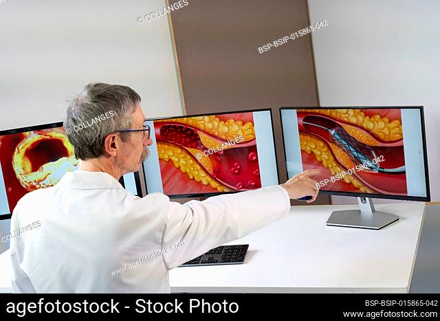 A doctor showing atheroma plaque and stent placement images on computer screens