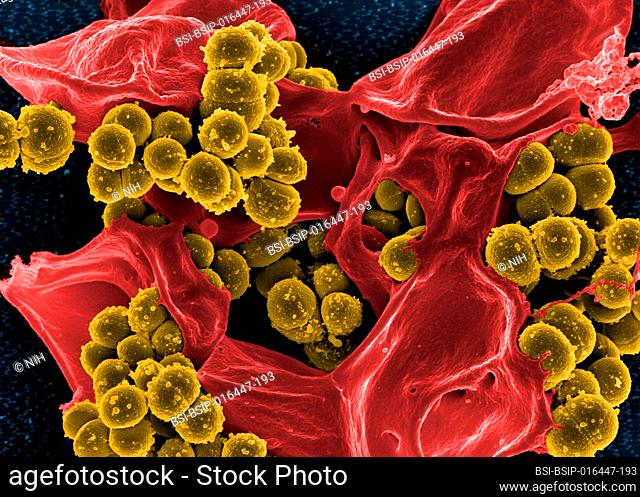 Scanning electron micrograph of methicillin-resistant Staphylococcus aureus bacteria (yellow) and a dead human white blood cell (colored red.)