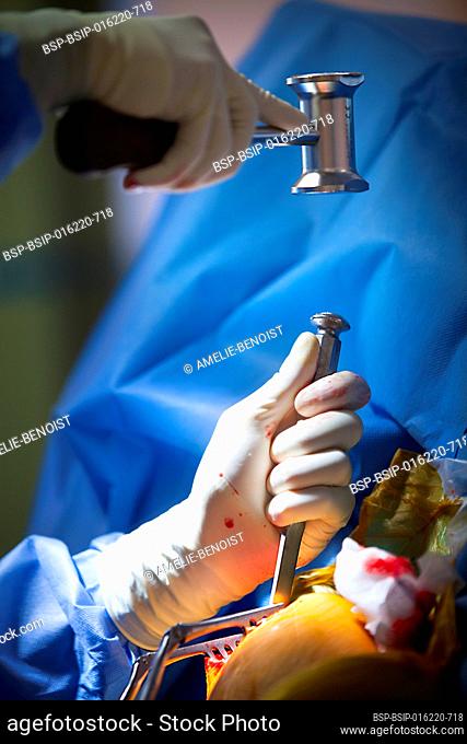 Orthopedic surgery operating room for acromioplasty and tenodesis of the biceps