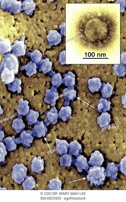 CORONAVIRUS<BR>This scanning electron micrograph reveals the 'rosettelike' appearance of the matured SARS-CoV (coronavirus) particles (arrows)