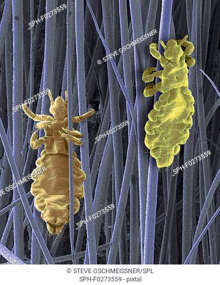 Coloured scanning electron micrograph (SEM) of Pediculus humanus capitis, human head lice. P. humanus is divided into two subspecies; the head louse P