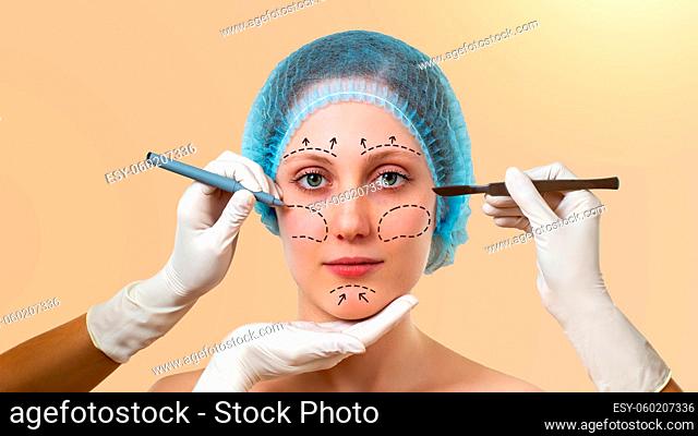 Portrait of woman with marks on face for plastic surgery. Young female with hands around preparing for cosmetic intervention