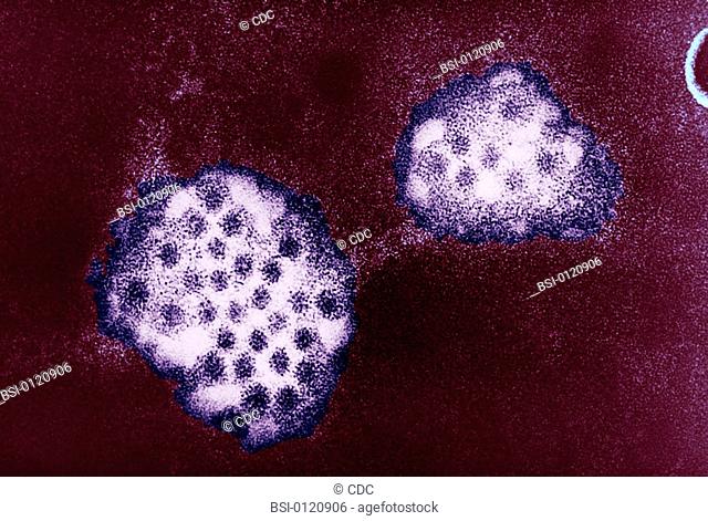 An electron micrograph of the Norovirus, with 27-32nm-sized viral particles. Norwalk viruses and related caliciviruses are important causes of nonbacterial...