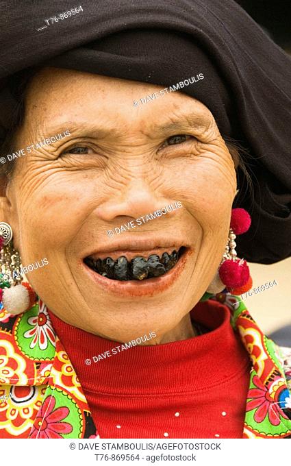 the black teeth of a Black Lu hilltribe woman in Tam Duong Vietnam  The married Lu women color their teeth with lacquer from trees to prevent tooth decay and as...
