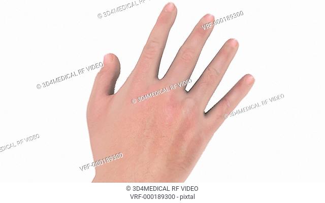 A pan around a male right hand which then zooms into a microscopic view under the fingernail of the middle finger. The camera comes to rest on MRSA or...