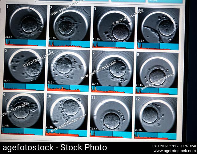 28 January 2020, Rhineland-Palatinate, Mainz: The monitor of the Timelaps Imaging System shows images of embryos. The Time-lapse Imaging System (T-lIS) allows...
