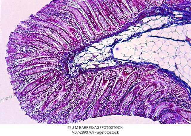 Cross section of intestine with villi. Optical microscopoe. Magnification X100