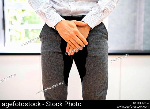 Man With Incontinence And Urinary Dysfunction. Pee Control Disorder