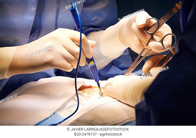 Surgery in operating room, Ambulatory Surgery, Hospital Donostia, San Sebastian, Basque Country, Spain
