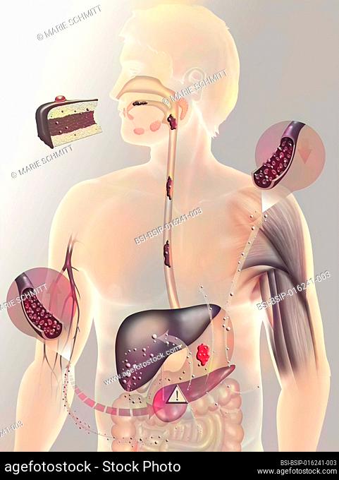 Secretion of insulin on a person with diabetes type 2. Diabetes type 2 (or non-insulin-dependent) is a form of diabetes mellitus affecting mainly adults over 40...