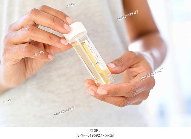 Woman holding urine sample