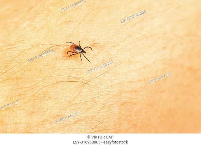 Tick - parasitic arachnid blood-sucking carrier of various diseases