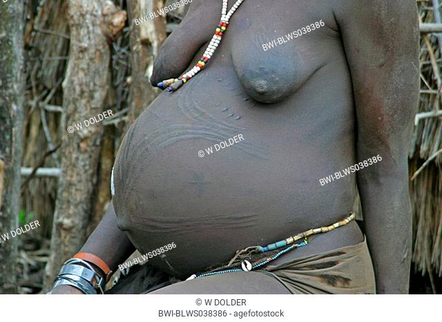 body of a pregnant Toposa woman, Sudan