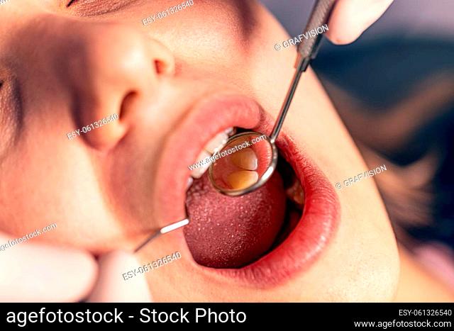 Young woman with open mouth at the dentist who uses mirror and a probe for making a diagnosis