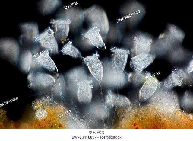 Vorticella (Vorticella spec.), with dark field microscopy