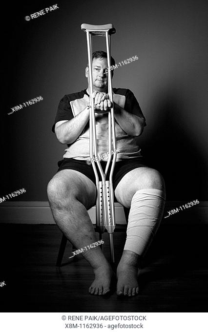 After surgery, a man with a surgically repaired broken leg with crutches