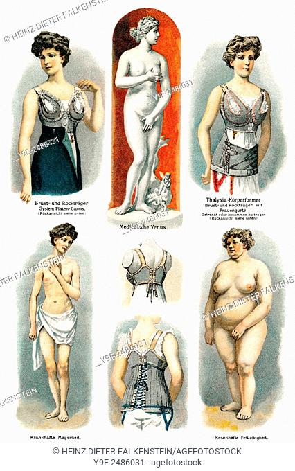 Abnormal and normal body shapes of women, health counselor, 19th century,